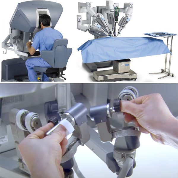 Robotik Prostat Ameliyatı Nasıl Yapılır? 2 Robotik cerrahi ile prostat ameliyatı nasıl yapılır?